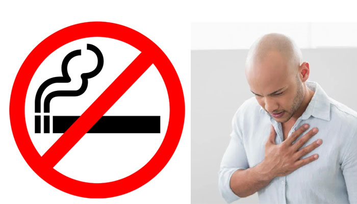 Lung Cancer Prevention