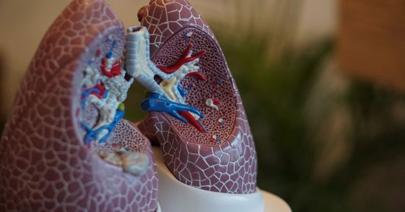 lung cancer se bachne ke upay