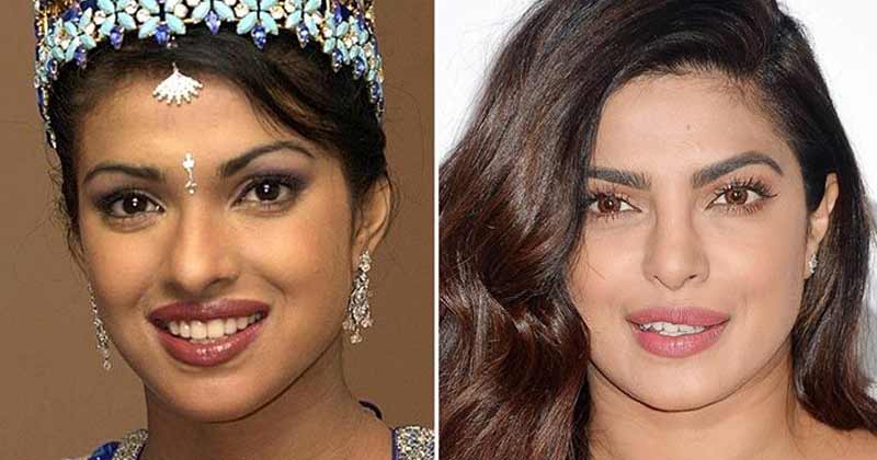 Bollywood Actress With Plastic Surgery
