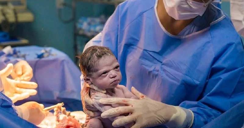 newborn baby frowns at doctor