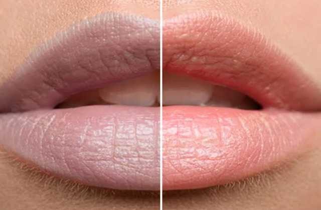 Natural Remedy for Dark Lips in Hindi