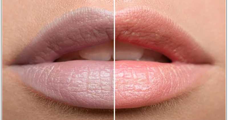 Natural Remedy for Dark Lips in Hindi