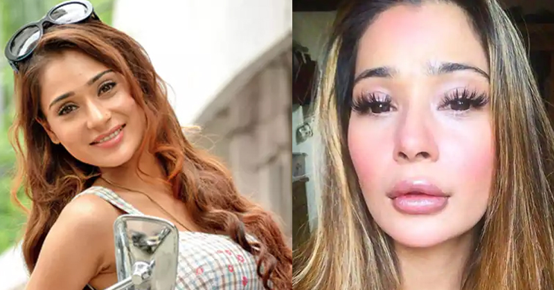 TV Actress who did Plastic Surgery