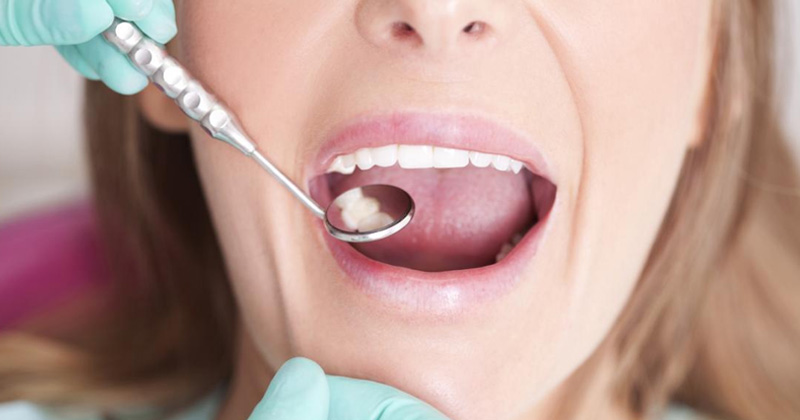 Teeth Causes Remedies