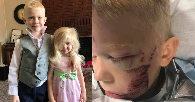 6 year old son survived brutal dog and saved her sister