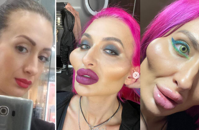 Ukranian Model claims biggest cheeks