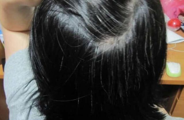Home Remedies For White Hair In Hindi