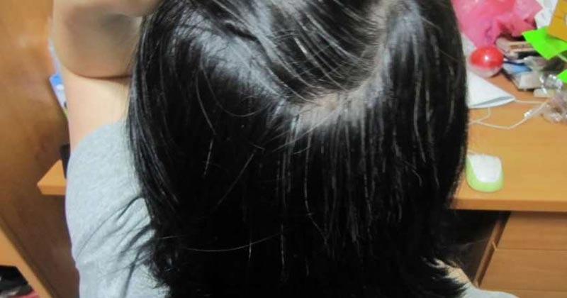 Home Remedies For White Hair In Hindi