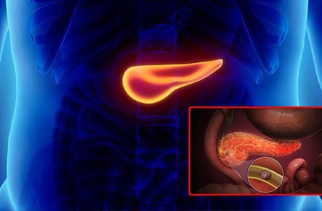 pancreas infection treatment in hindi