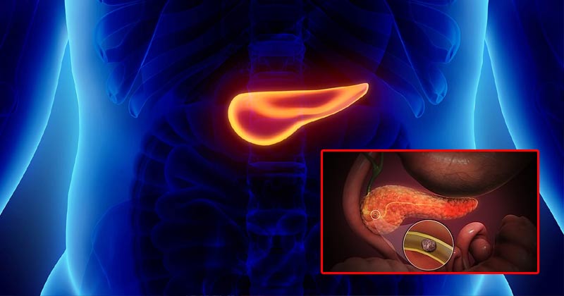 pancreas infection treatment in hindi