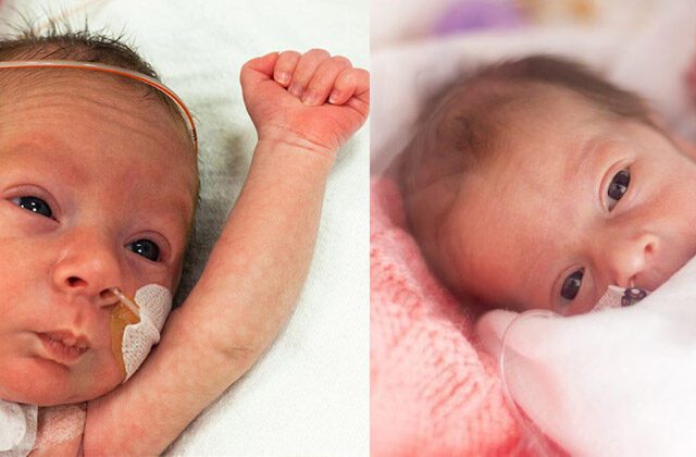 Premature Baby Care Tips In Hindi