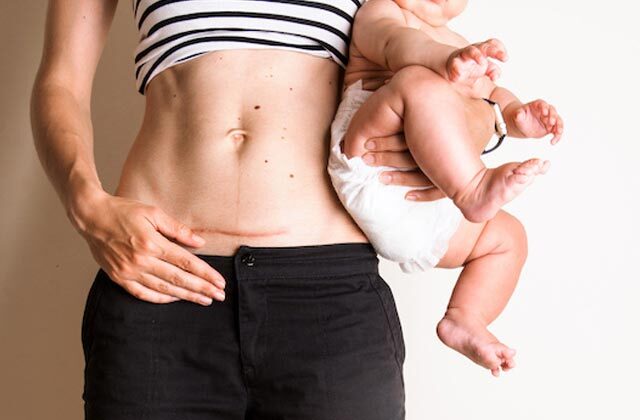 Pregnancy After Cesarean Delivery how long to wait in hindi