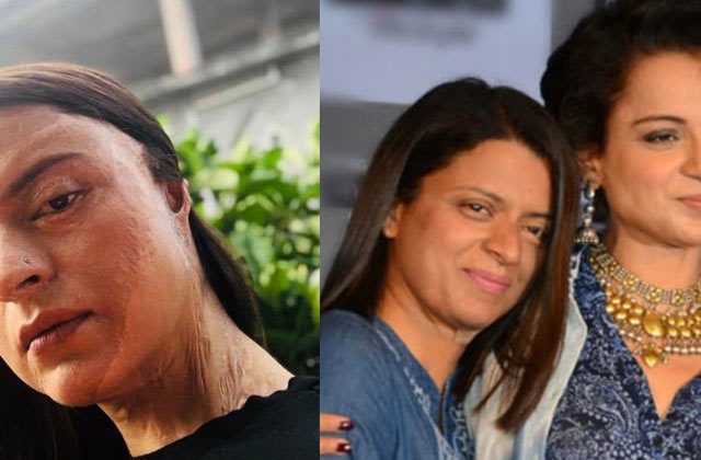 Kangana Ranaut recalls acid attack on sister Rangoli Chandel