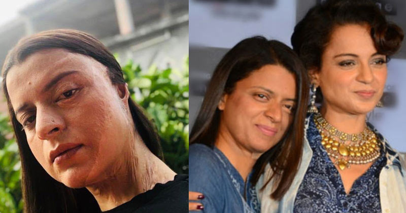 Kangana Ranaut recalls acid attack on sister Rangoli Chandel
