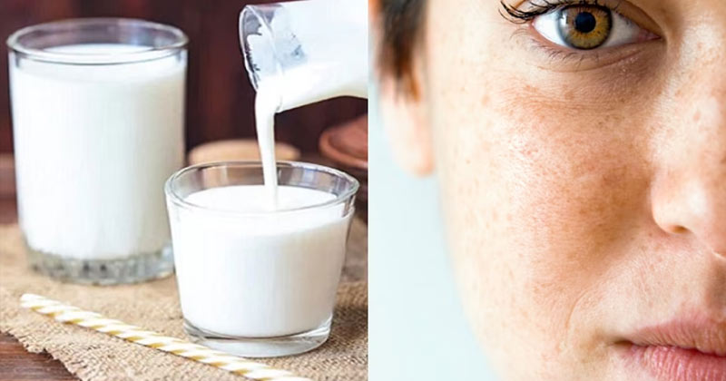 Buttermilk Benefits For Skin In Hindi