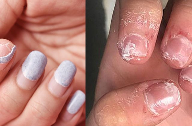 nail extension side effects