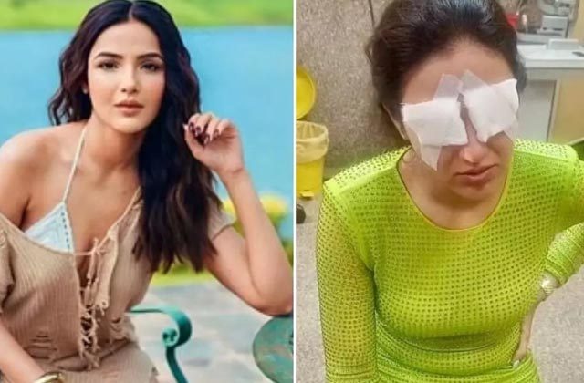 Jasmin Bhasin Suffers Corneal Damage From Lenses