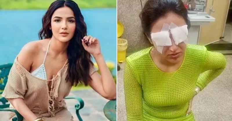 Jasmin Bhasin Suffers Corneal Damage From Lenses