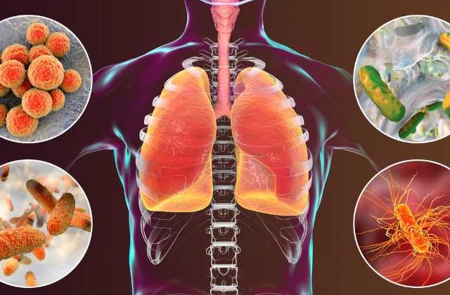 Fefdo Me Infection Ke Lakshan